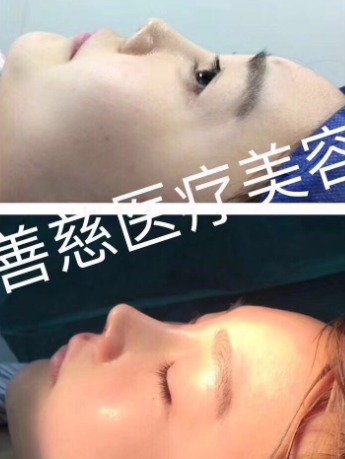 微信图片_20180228182820.png